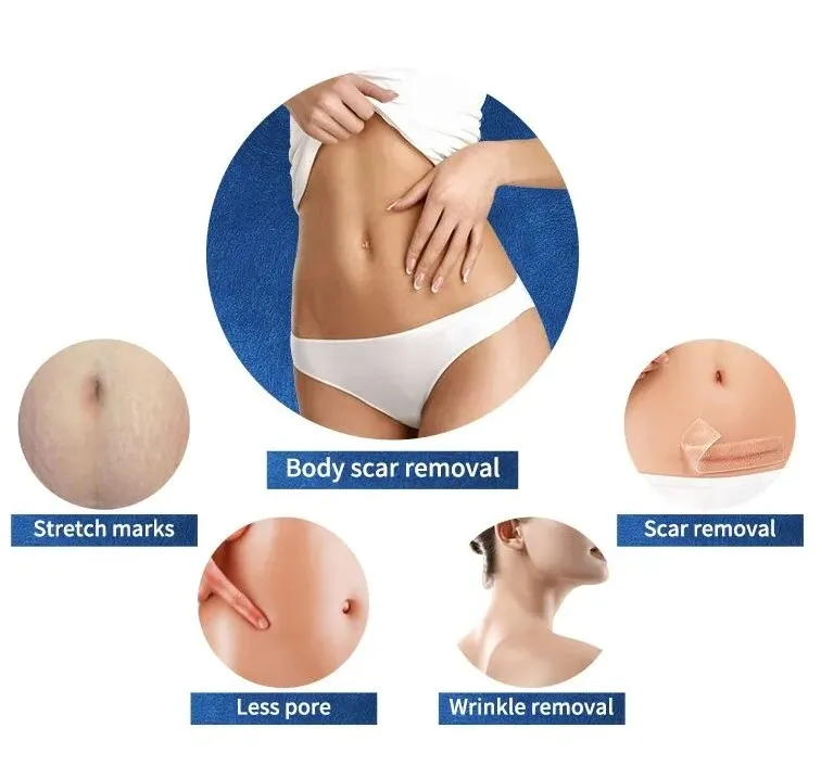 Morpheus 8 Machine 3 Morpheus 8 Machine 3